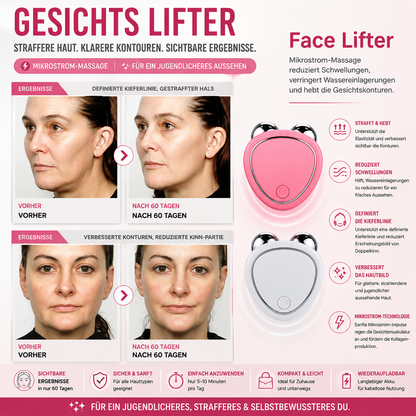 Gesichtsroller mit Mikrostromfunktion